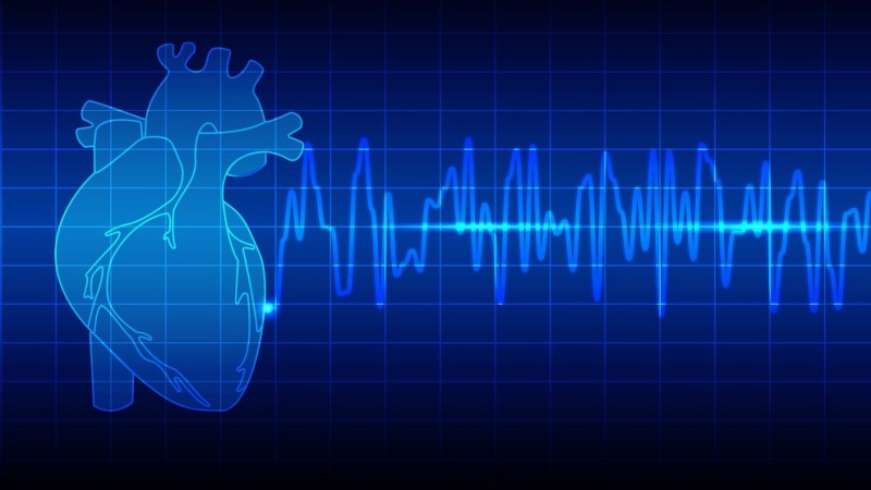 نوار قلب (ECG, EKG) چیست؟